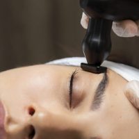 Radiofrecuencia Facial